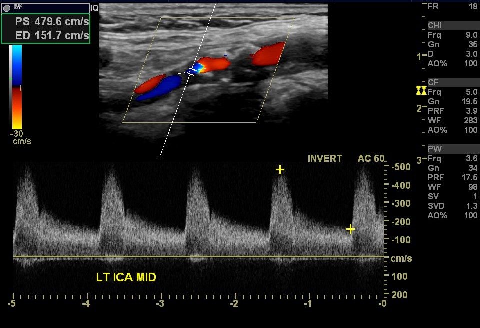 مصدر الصورة: ويكي ميديا&nbsp;