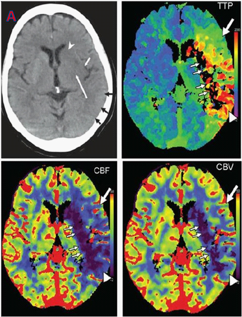 النشرة البريدية للجمعية الألمانية السورية لطب الأعصاب - العدد #4