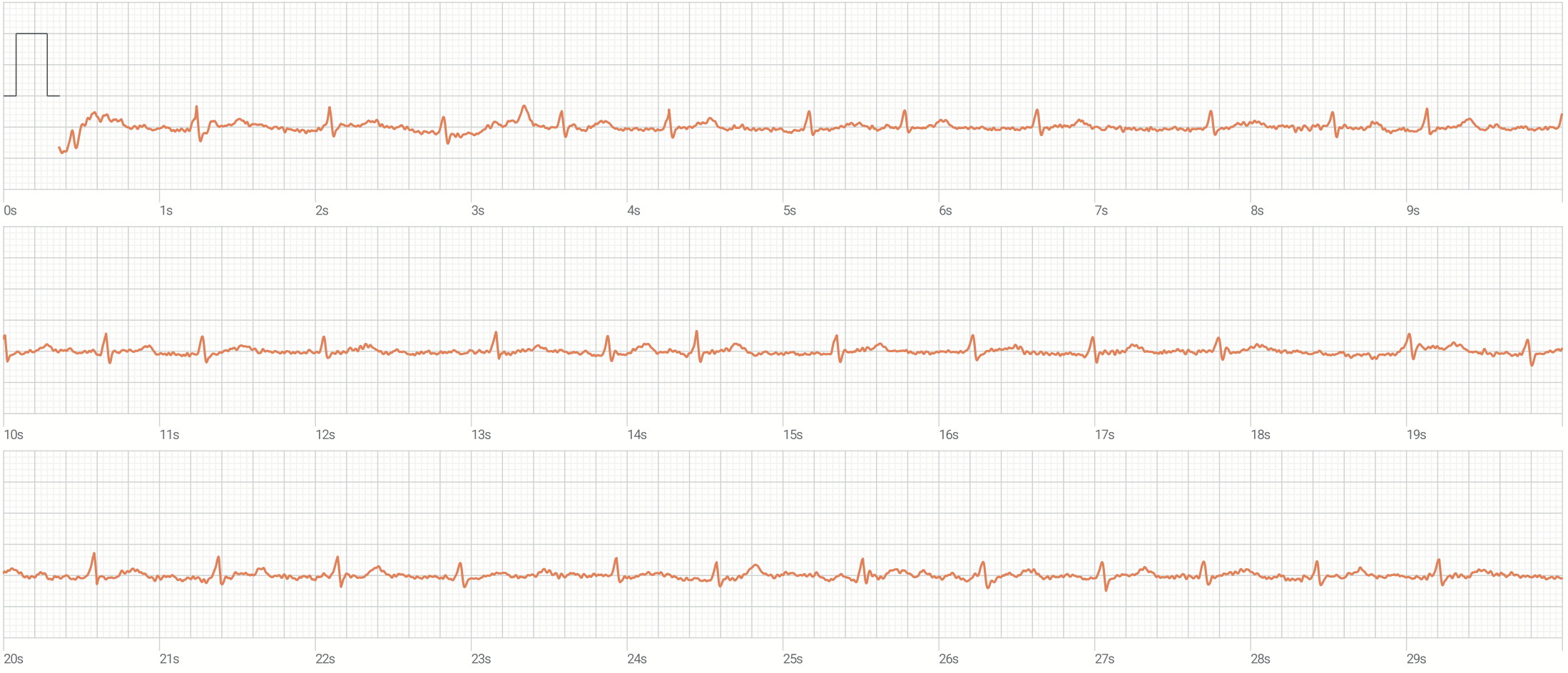 مصدر الصورة: ويكي ميديا